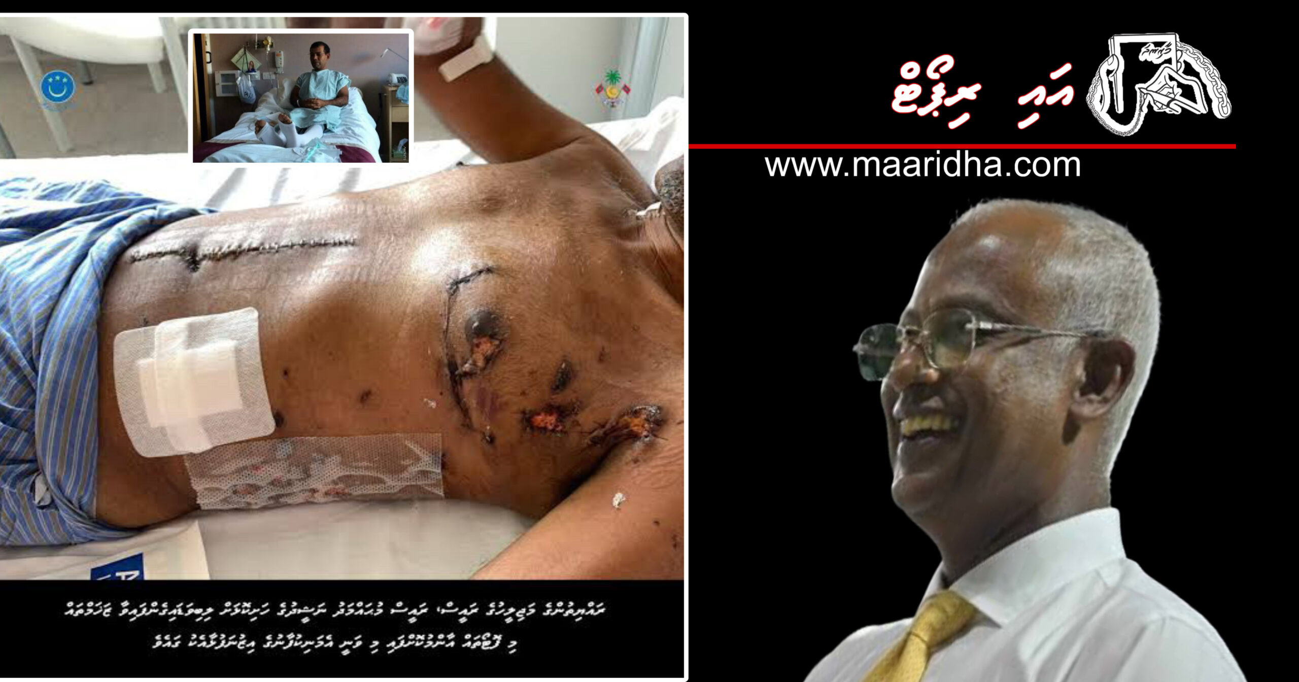 އައި ރިޕޯޓް: ވެރިކަމުގެ ލައްޒަތާ ޖާހަތަށްޓަކާ ކުޑައިރުއްސުރެ އެކު އުޅުނު ދޯސްތު ވުޖޫދުން ފޮހެލަން އުޅުއްވި އަނިޔާވެރިޔާ